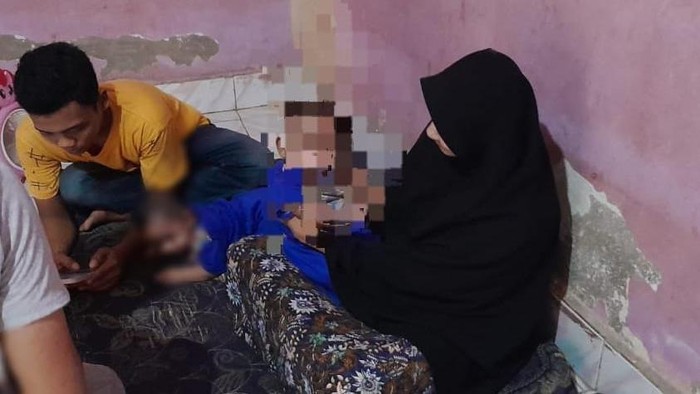 Bayi di Sinjai, Sulsel terlahir tanpa anus alias atresia ani.