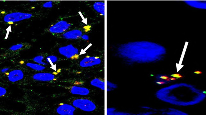 Studi Baru Temukan Otak Bayi Rusak gegara COVID-19, Virus Menembus Plasenta