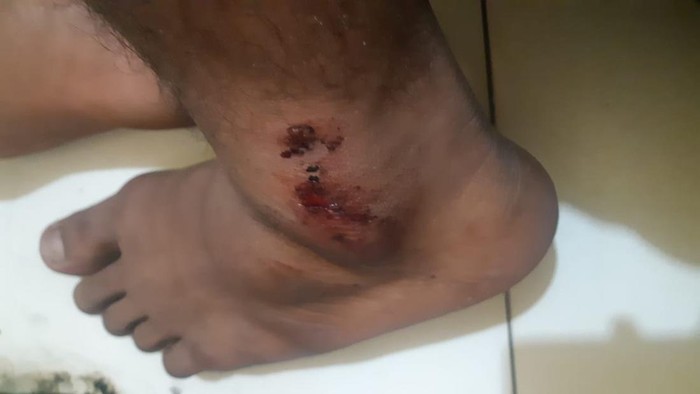 Tahanan disiksa Pasuruan