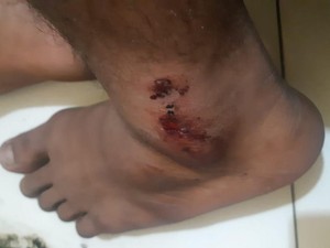 Tersangka Perusak Pasar di Pasuruan Ngaku Disiksa Saat Ditangkap