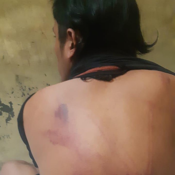 Tahanan disiksa Pasuruan