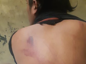 Tahanan Polres Pasuruan Ngaku Dianiaya dan Dipaku, Propam Selidiki