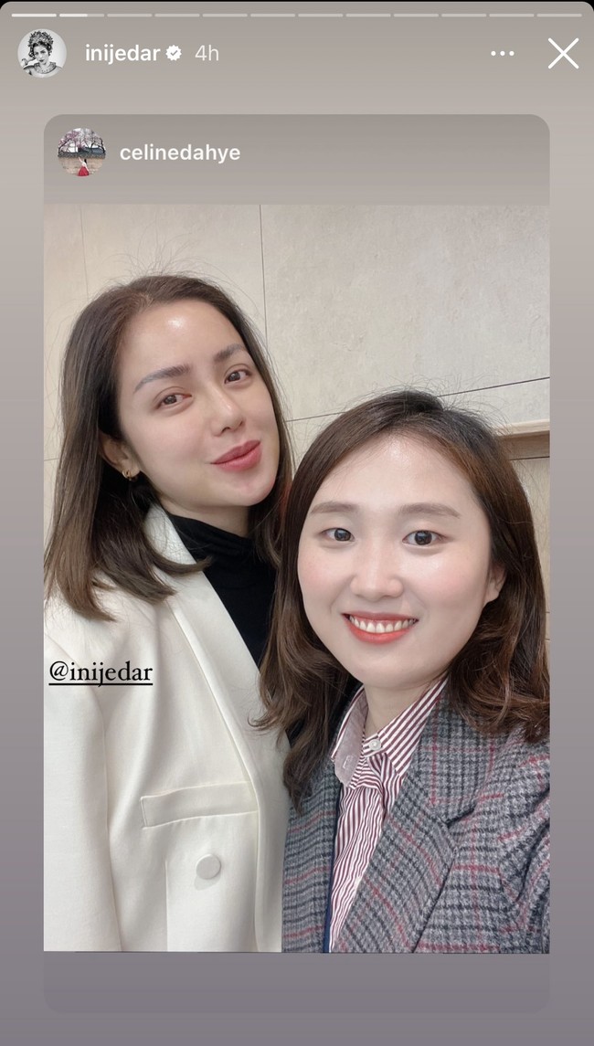 Kini melalui Instagram Story miliknya Jedar terlihat sudah kembali memamerkan bentuk hidung barunya tanpa plester. Jika diperhatikan hidungnya kini jadi terlihat semakin mancung dan kecil. Foto: Instagram/@inijedar