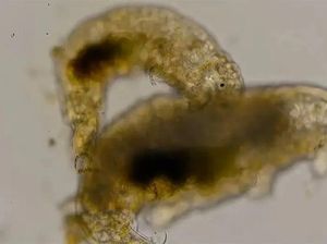 Peneliti Lihat Tardigrade Lagi Threesome