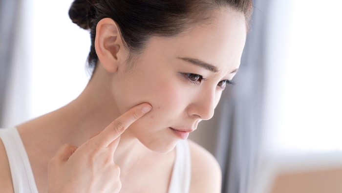 Cara Menghilangkan Chicken Skin di Wajah, Simak Penyebab, dan Gejalanya