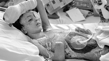 Wartawan foto Deanne Fitzmaurice  menjadi pemenang penghargaan Pulitzer pada tahun 2005 berkat esai fotografi berjudul Operation Lion Heart. Mengisahkan tentang seorang bocah lelaki Irak berusia 9 tahun yang terluka parah akibat ledakan selama Perang Irak. Bocah itu dibawa ke rumah sakit di Oakland, CA di mana dia harus menjalani puluhan operasi hidup dan mati. Keberanian dan keengganannya untuk mati memberinya julukan Saleh Khalaf atau Lion Heart. Foto: via steemit