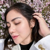 Inilah wajah Jessica Iskandar setelah benar-benar pulih. Tulang hidungnya tampak lebih tinggi dan simetris. Foto: Instagram/@inijedar