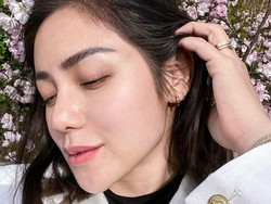 8 Foto Transformasi Wajah Jessica Iskandar Before-After Operasi Hidung