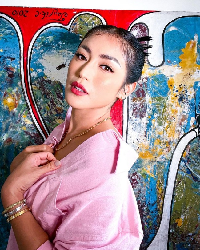 Operasi juga dilakukan guna meluruskan tulang hidungnya. Prosedur operasi dikerjakan pada 13 April 2023. Foto: Instagram/@inijedar