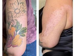 Potret Seni Tato Tutupi Bekas Luka Menjadi Artistik