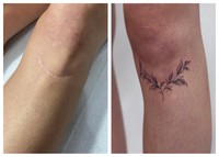 Fotoinet Seni Tato Menutupi Tubuh yang Tak sempurna Menjadi Artistik
