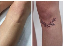 Potret Seni Tato Tutupi Bekas Luka Menjadi Artistik