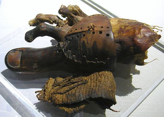 Kaki prostetik kayu dari peradaban Mesir kuno untuk bantu orang di masa itu berjalan.