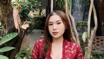 Potret Audrey Davis Putri David yang Disebut Polisi Jadi Pemeran Video Syur