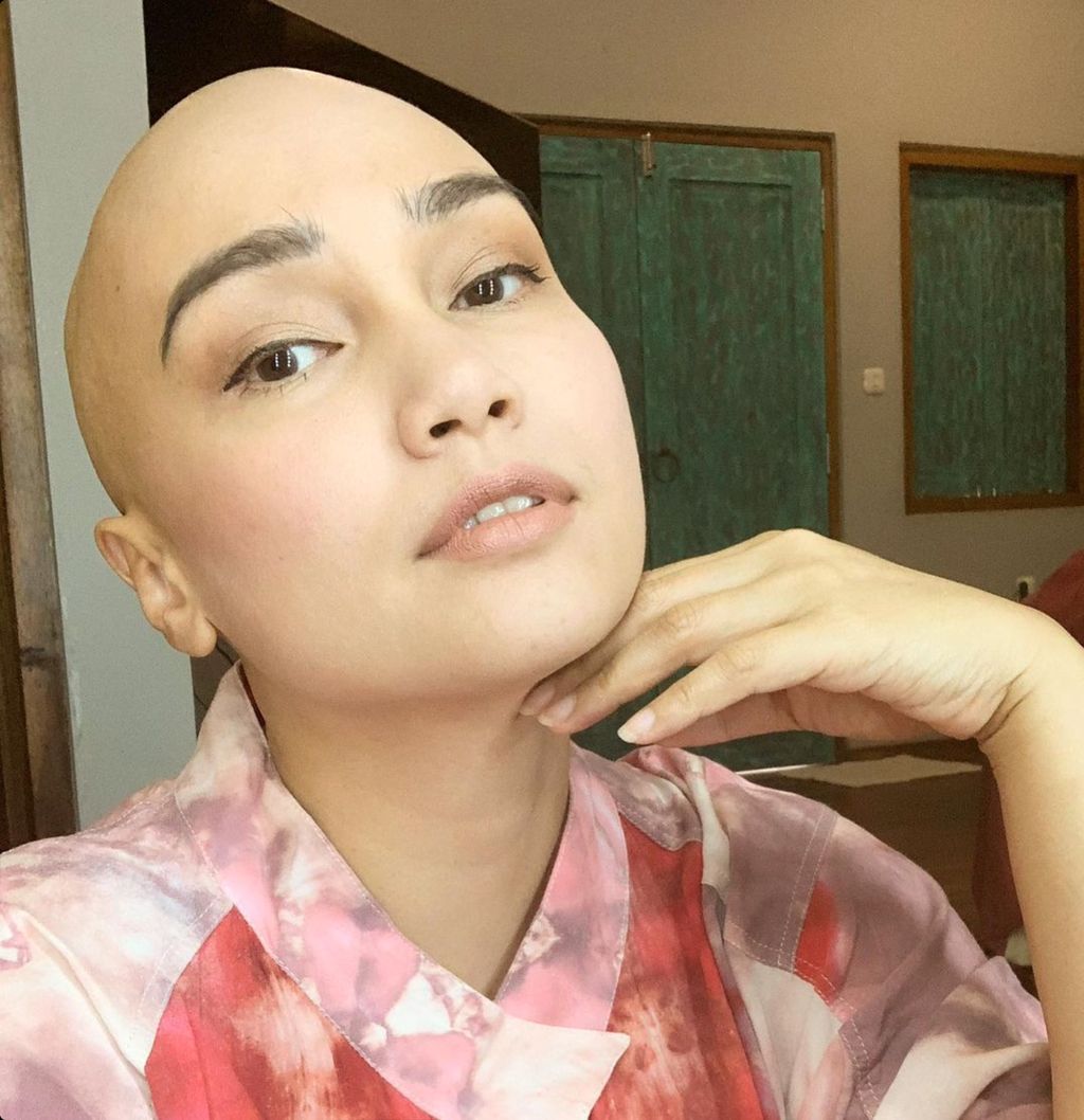 Artis wanita pejuang kanker yang sempat tampil berkepala plontos