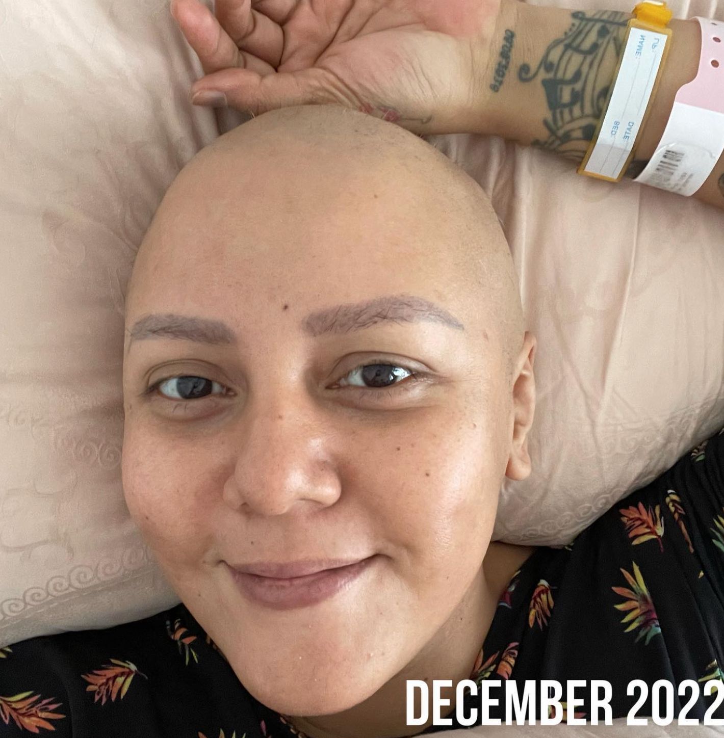 Artis wanita pejuang kanker yang sempat tampil berkepala plontos