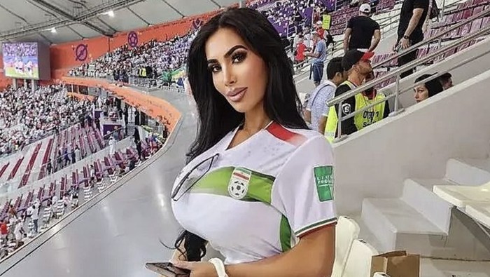 Oplas Biar Mirip Kim Kardashian, Model Ini Meninggal Akibat Henti Jantung