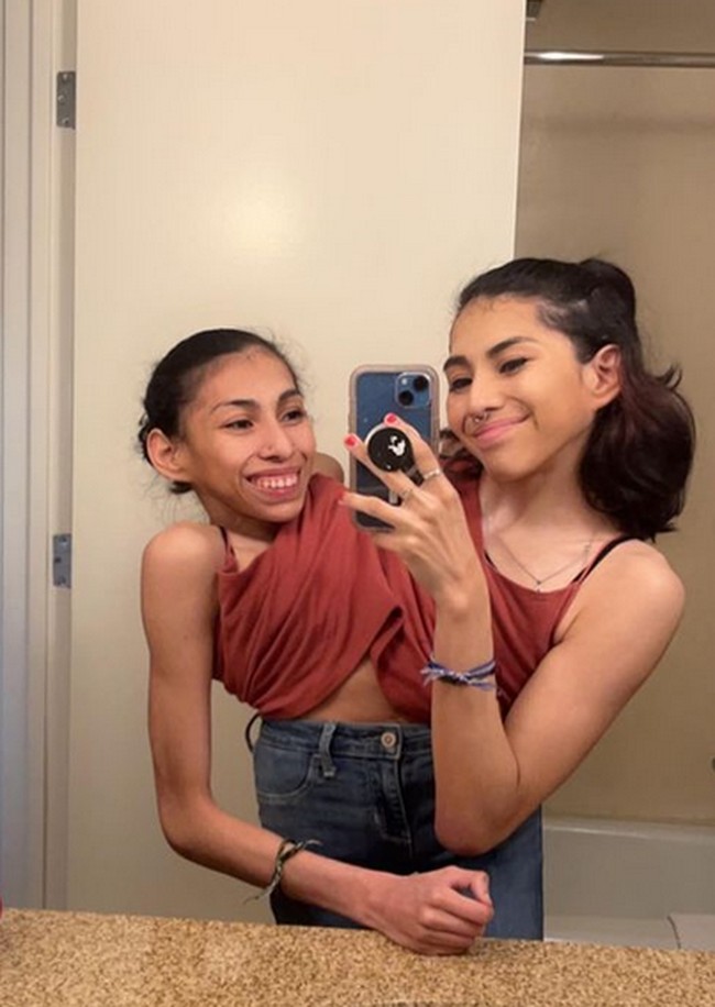 Carmen mengaku bahwa hubungannya dengan Daniel begitu dekat, meski tidak berhubungan intim. Keduanya pun telah membahas tentang masa depan, namun Carmen dan Lupita tidak bisa hamil karena menderita endmetriosis dan keduanya menggunakan pemblokir hormon untuk mencegah menstruasi. Foto: dok. Instagram/@carmen_andrade2000