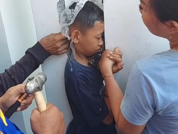 Proses evakuasi bocah kepalanya terjepit pilar