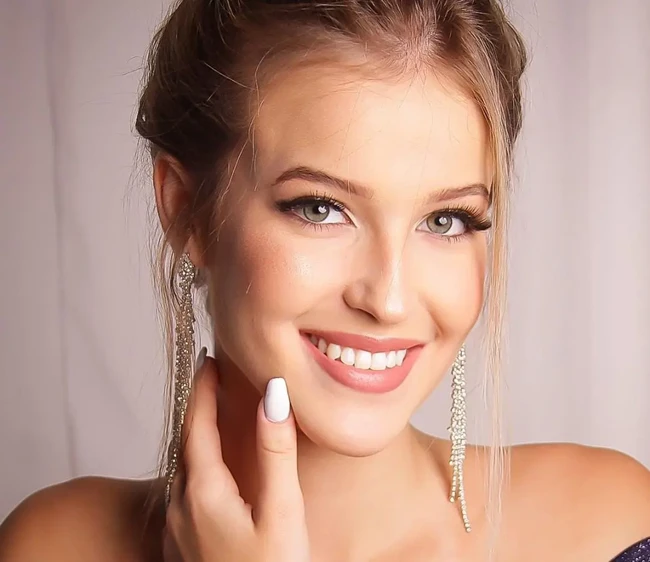 Pernikahan sang walikota dan ratu kecantikan remaja ini jadi sorotan karena usia keduanya menjadi suami istri, ibunda Kauane Rode, Marilene Rode yang sebelumnya sudah duduk di pemerintahan mendapatkan kenaikan jabatan. Foto: Dok. Facebook, Instagram