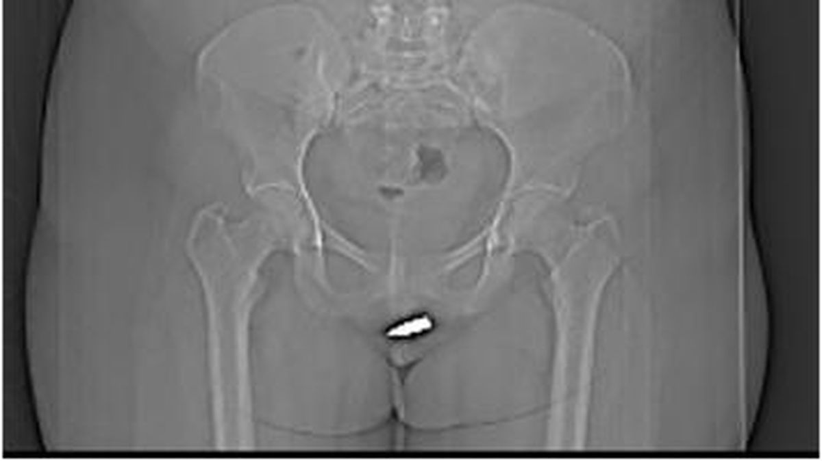 Porno video: Oila uchun massaj terapevtini chaqirish