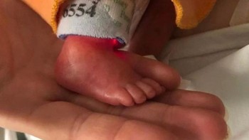 Kaki bayi baru lahir punya jempol yang besar? Foto: Brightside