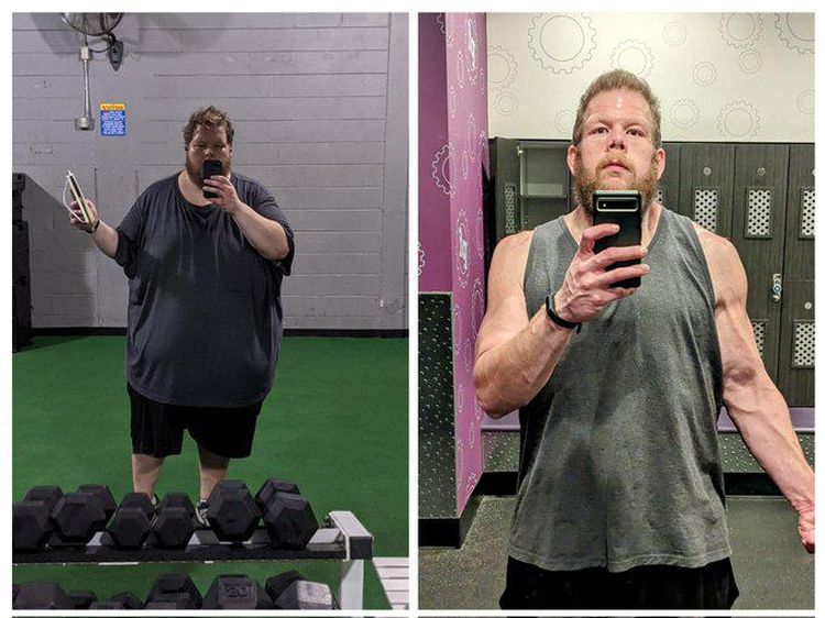 Potret Pria Pangkas BB hingga 152 Kg! Before-Afternya Bikin Merinding