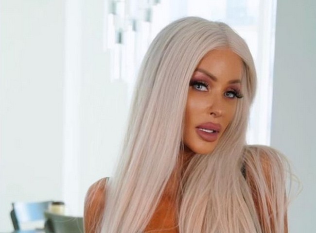 Dulu Nannette hidup bergelimang harta. Operasi plastik, perawatan kecantikan dan baju-baju dari desainer baginya dulu bukanlah sebuah kemewahan. Foto: dok. Instagram/ nannettehammondloschiavo