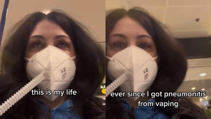 Paru Wanita Ini Rusak Berat Akibat Vape, Harus Selalu Pakai Masker Filter