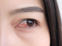 Ngeri, Dokter Temukan 4 Cacing Hidup di Mata Wanita China Ini