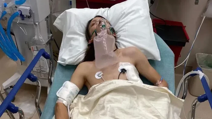 Paru-paru Kolaps gegara Ngevape, Kisah Nahas Remaja Berakhir di RS