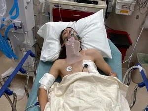 Paru-paru Kolaps gegara Ngevape, Kisah Nahas Remaja Berakhir di RS