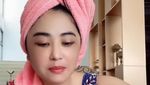 5 Potret Wajah Baru Dewi Perssik Disorot Netizen usai Operasi Kelopak Mata