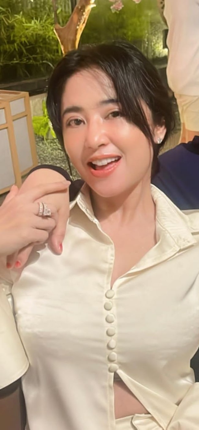 Belakangan penampilan Dewi Perssik kembali mencuri atensi karena wajahnya yang terlihat bengkak. Bukan operasi plastik, rupanya Dewi melakukan operasi transfer lemak pada area matanya. Foto: Instagram @dewiperssik9