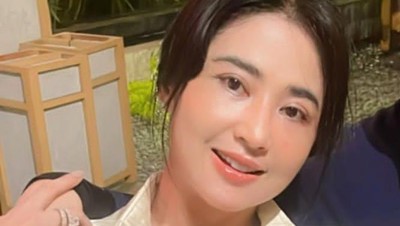 7 Foto Transformasi Dewi Perssik, Wajah Usai Operasi Transfer Lemak Disorot