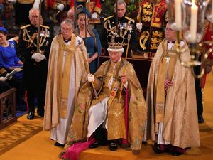 Fakta-fakta Kondisi Kesehatan Raja Charles III, Jarinya Bengkak Mirip Sosis