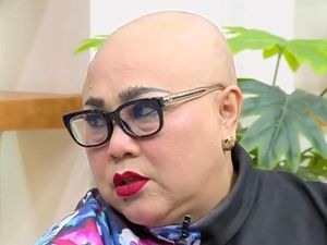 Nunung Nggak Nangis Lagi Usai Botak karena Kemo: Air Matanya Habis