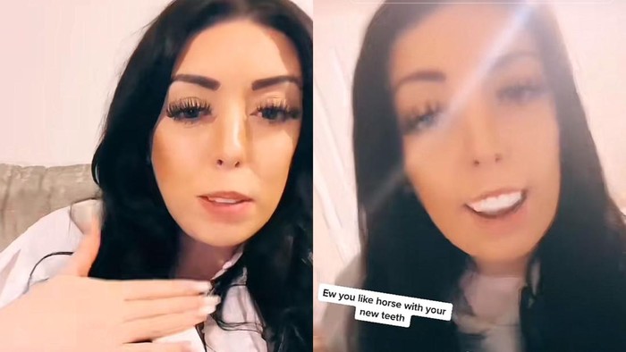 Viral Bayar Rp 73 Juta buat Veneer Gigi, Endingnya Malah Begini