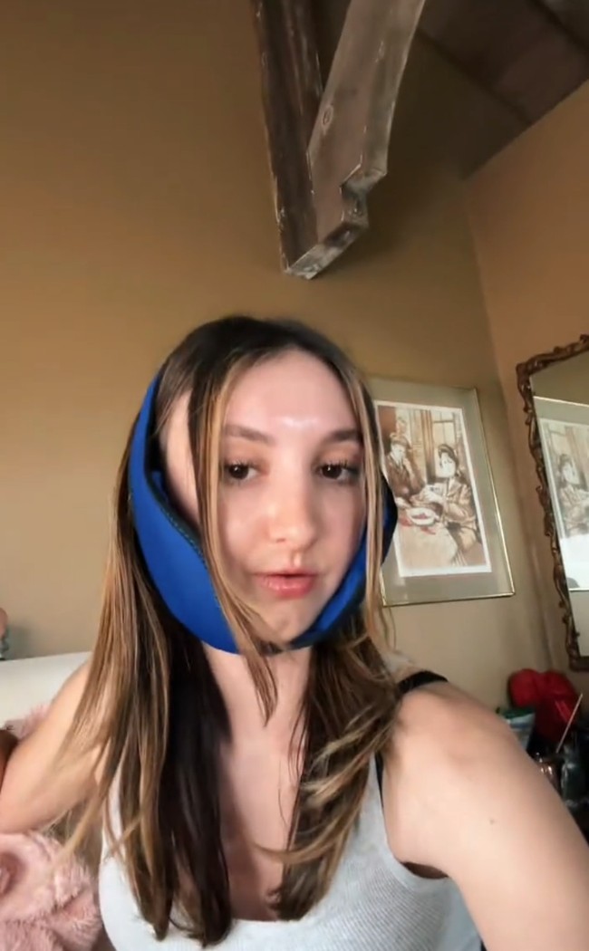 Sebelum operasi plastik, sejak usia delapan tahun ia sudah melakukan berbagai perawatan untuk memperbaiki rahangnya, termasuk dengan memakai behel sebanyak enam kali.Foto: Dok. TikTok