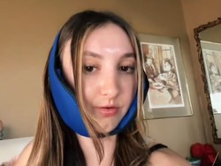 Transformasi Wanita Setelah Oplas Rahang Rp 2,9 M, Dulu Dibilang Mirip Tupai