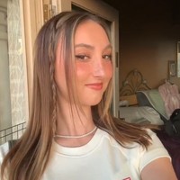 Setelah operasinya selesai, awalnya Izzy takut untuk melihat diri sendiri. Ia bahkan meminta ayahnya untuk menutupi cermin di rumah sakit. Setelah sempat menangis karena merasa itu bukan wajahnya kini Izzy megnaku sangat puas dengan perubahannya.Foto: Dok. TikTok