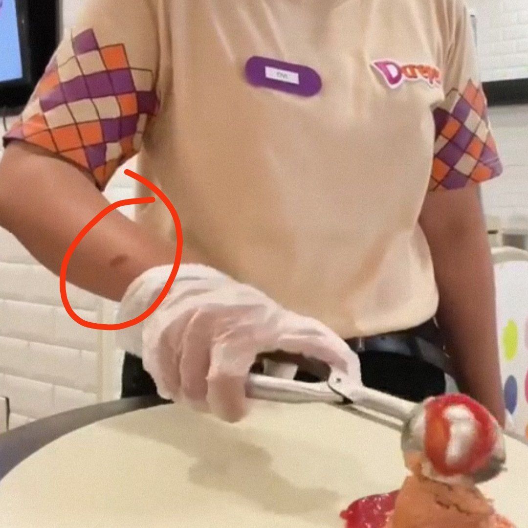 Heboh Tangan Pekerja Ada Bekas Luka, Ini Tanggapan Dcrepes