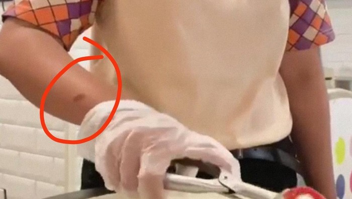 Heboh Tangan Pekerja Ada Bekas Luka, Ini Tanggapan Dcrepes