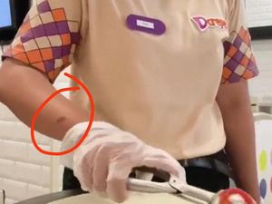 3 Fakta Viral Banyak Pegawai dCrepes Kena Luka Bakar