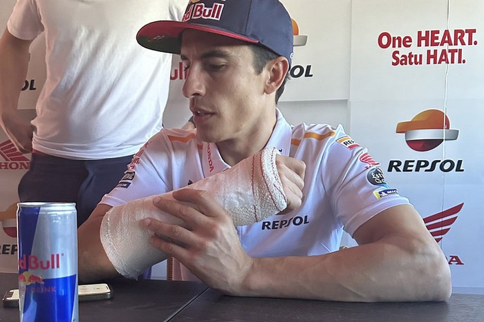 Marc Marquez sembuh cedera.