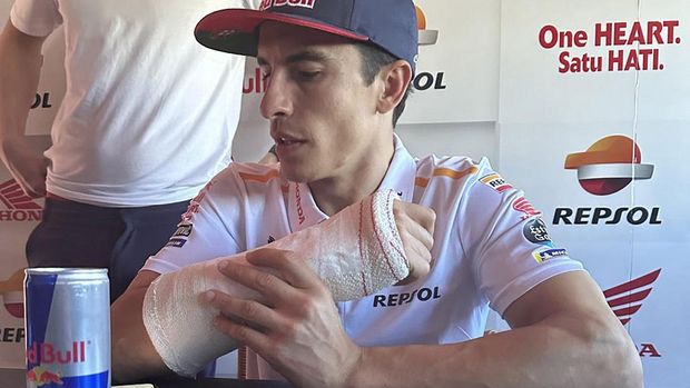 Marc Marquez sembuh cedera.