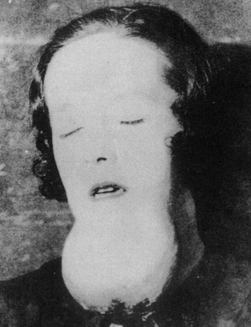 Foto jadul mengerikan