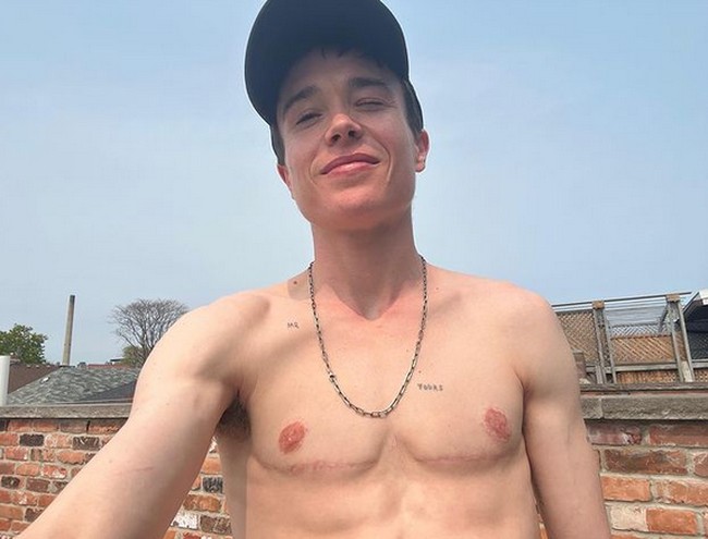 Baru-baru ini, aktor yang dulunya bernama Ellen Page itu tampil tanpa busana. Dengan jelas ia menunjukkan bekas luka sayatan di area dadanya. Elliot membahas bahwa ia kini lebih merasa senang bisa membuka kausnya di tengah musim panas. Foto: dok. Instagram