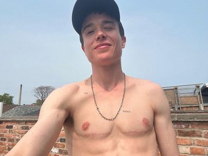 Transgender Elliot Page Tunjukkan Bekas Luka Setelah Operasi Angkat Payudara
