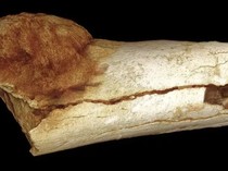 Fosil Purba Berusia 1,7 Juta Tahun Ungkap Manusia Pertama yang Kena Kanker